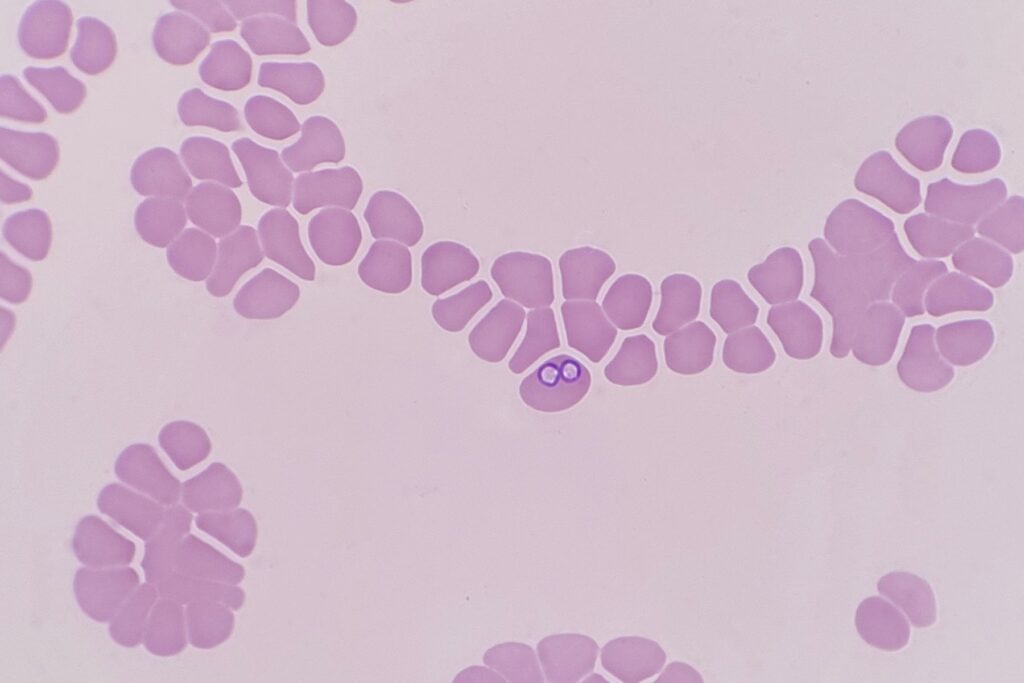 Pierwotniaki Babesia