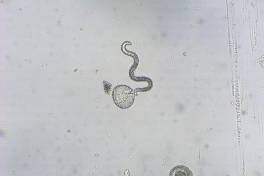 Glista psia pod mikroskopem